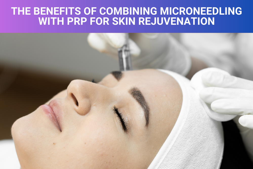 The Benefits of Combining Microneedling with PRP for Skin Rejuvenation